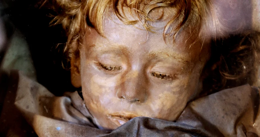 Rosalia Lombardo'nun Gizemi: Gözlerini Açıyormuş Gibi Görünen Mummy